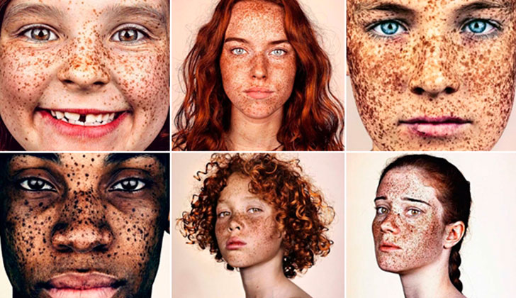 Fotógrafo recorre el mundo para retratar la belleza de las personas con pecas.