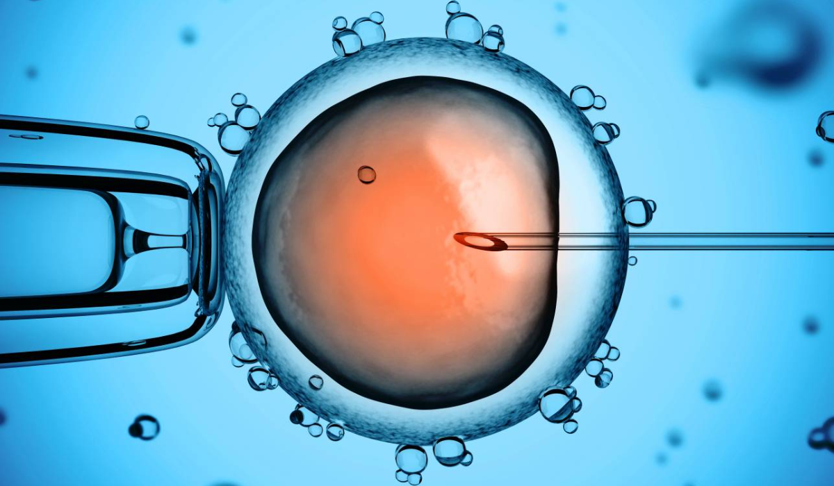 La Microinyección Intracitoplásmica de Espermatozoides es un tratamiento de reproducción asistida incluida dentro de la fecundación in vitro.  